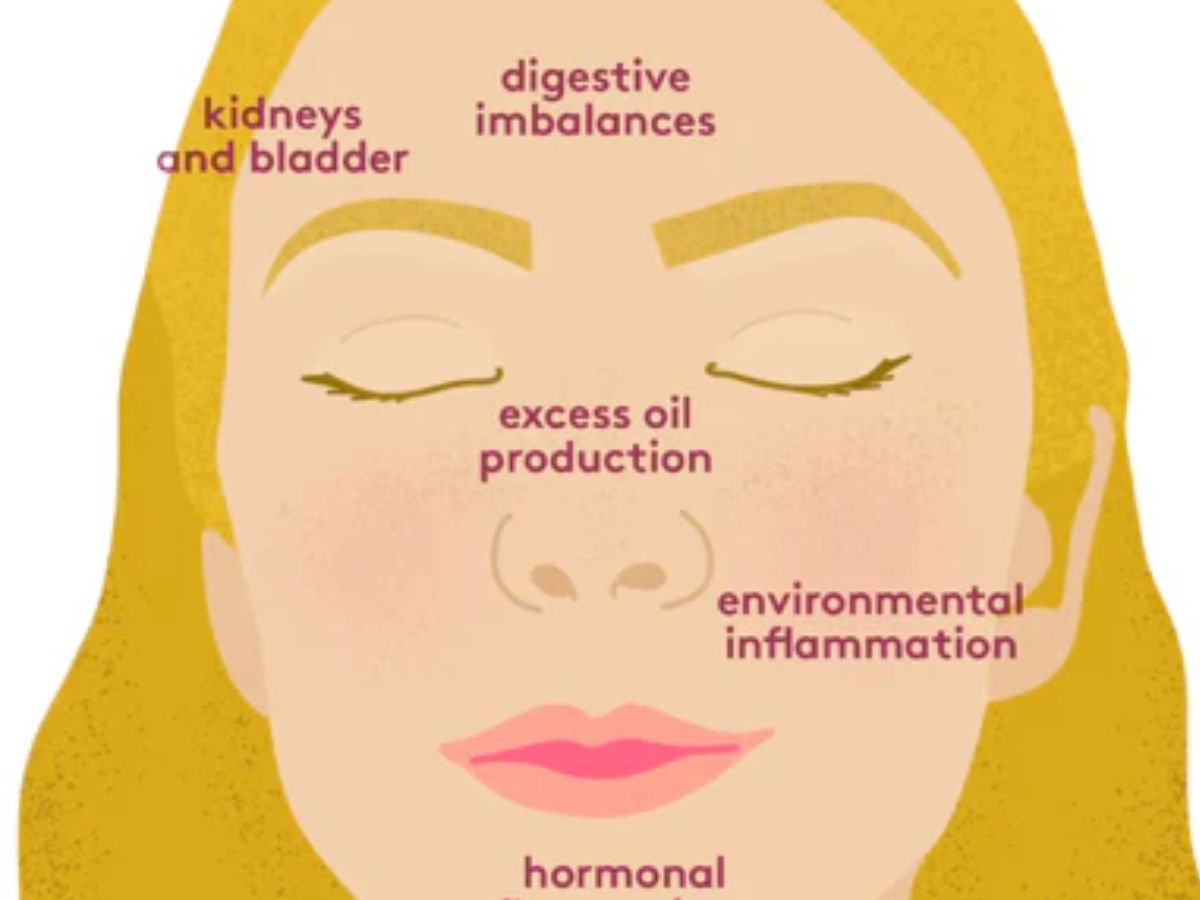 What’s Causing My Breakouts?