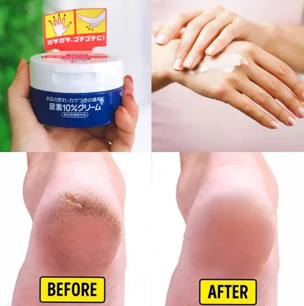 Shiseido - Urea 10% Hand & Foot Cream 100g